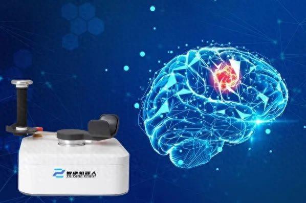 8868体育官方网站【中华武数】足不出户、玩着游戏就能康复理疗普陀自主研发的“背包康复师”打通居家“最后一公里”